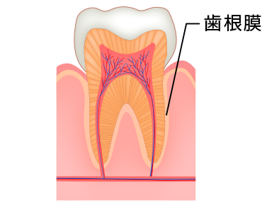 歯根膜炎
